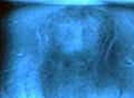 jesus on a dental x-ray