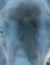 negative image